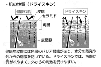 アトピー図1