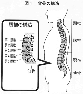 坐骨神経痛の図1